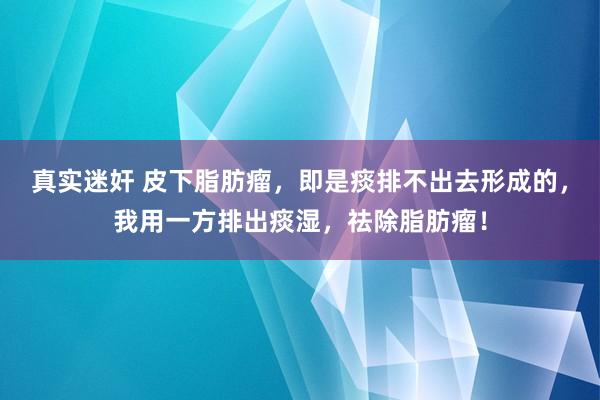 真实迷奸 皮下脂肪瘤，即是痰排不出去形成的，我用一方排出痰湿，祛除脂肪瘤！